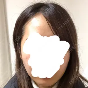 92 days after image