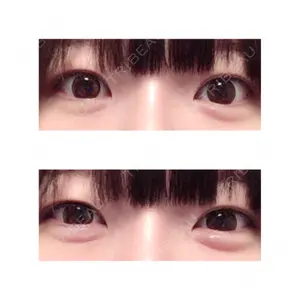 83 days after image