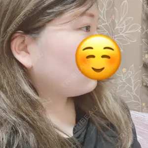 5 days after image