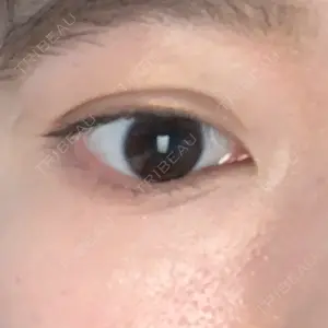 4 days after image