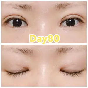 80 days after image