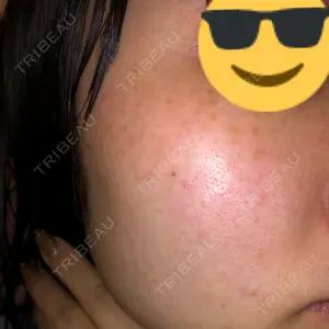 40 days after image