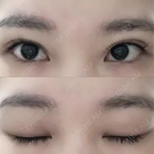 14 days after image
