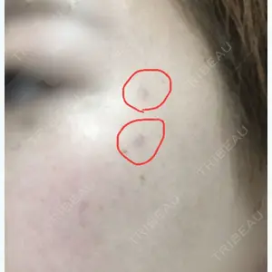 130 days after image