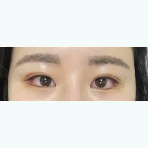 62 days after image
