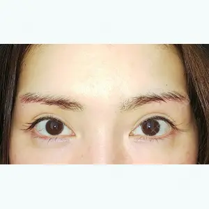 73 days after image