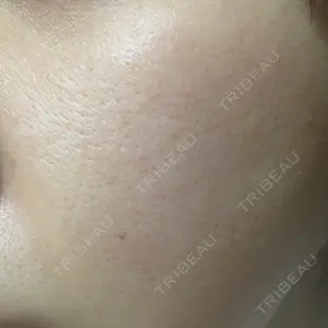 28 days after image