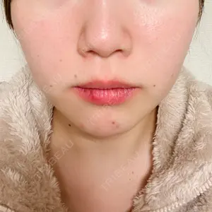 116 days after image