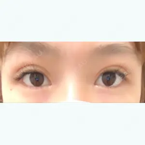 40 days after image