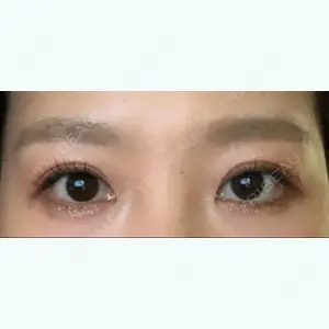89 days after image