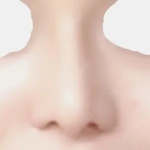 31 days after image
