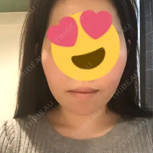 28 days after image
