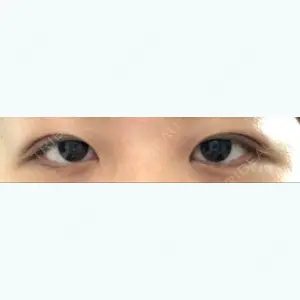 10 days after image
