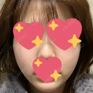 152 days after image