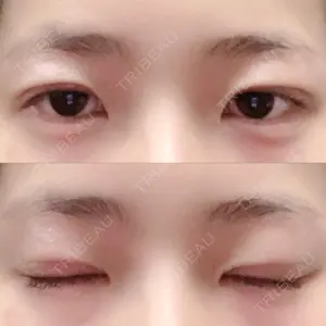 6 days after image