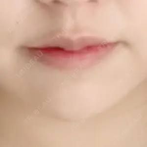 43 days after image