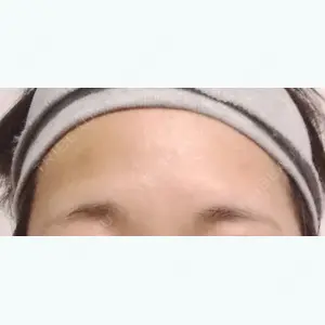 28 days after image