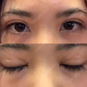 6 days after image