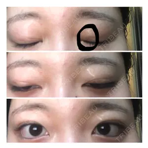 19 days after image