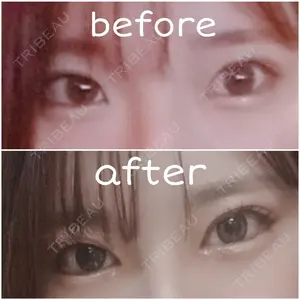 115 days after image