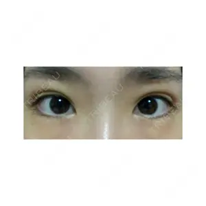 2 days after image