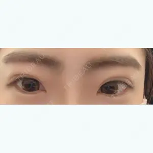 179 days after image
