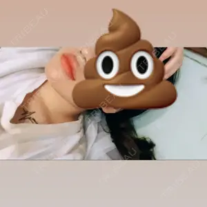 0 days after image