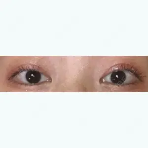 33 days after image