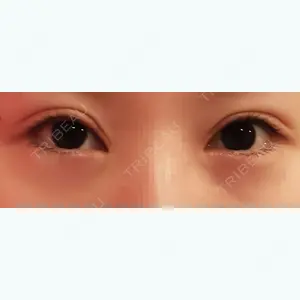 68 days after image