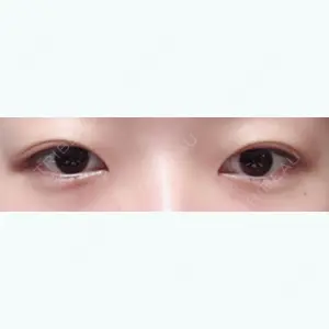 140 days after image
