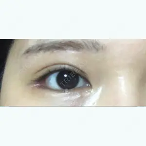 78 days after image