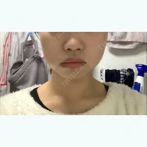 15 days after image