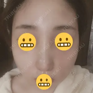 13 days after image