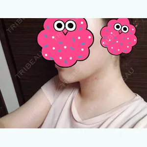 3 days after image