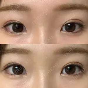 43 days after image