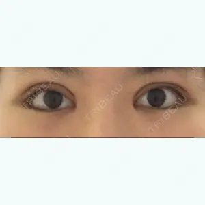 36 days after image