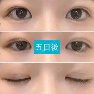 5 days after image