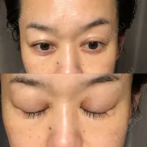 121 days after image