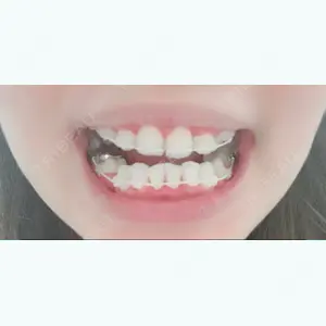 161 days after image
