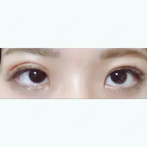 10 days after image