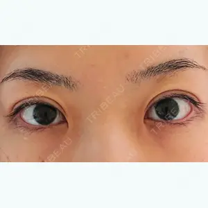 165 days after image