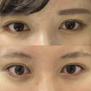 ウォンジン（Wonjin）整形外科口コミ