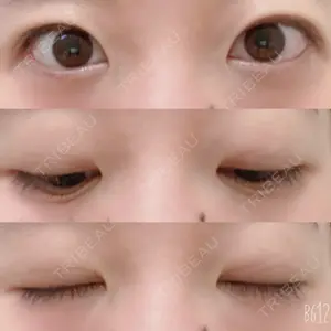 29 days after image