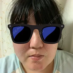 92 days after image