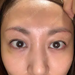 51 days after image