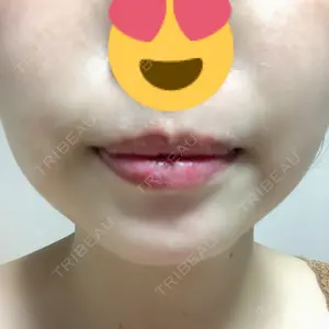 40 days after image
