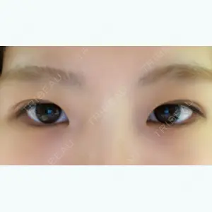 61 days after image