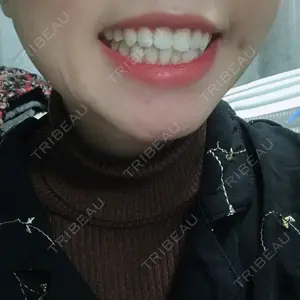 0 days after image