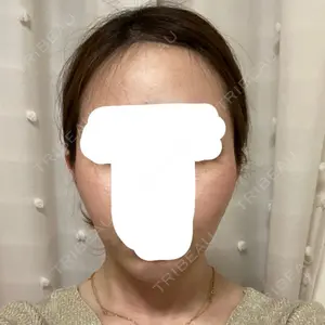 209 days after image