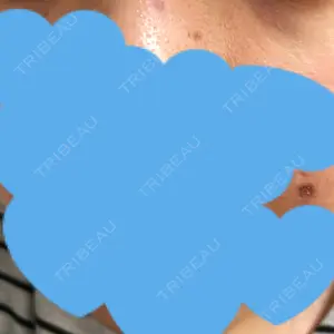 16 days after image